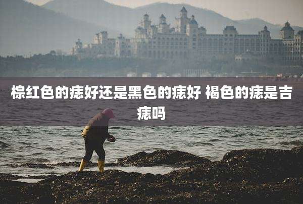 棕红色的痣好还是黑色的痣好 褐色的痣是吉痣吗