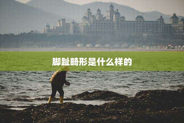脚趾畸形是什么样的